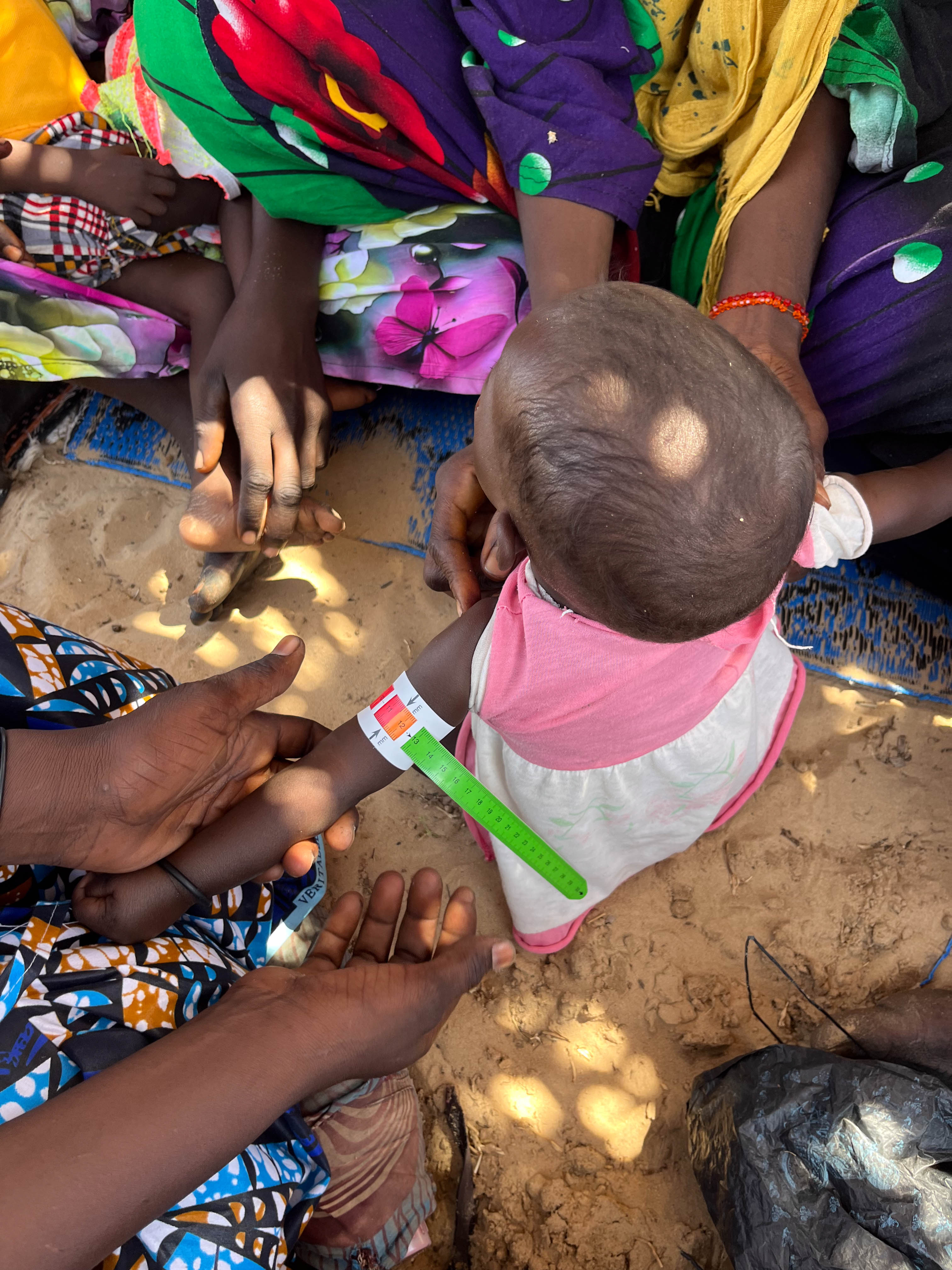 MUAC screening of a child in Chad
